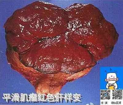 在供卵试管婴儿期间，女性的正常卵泡数量是多少？是不是越多越好？