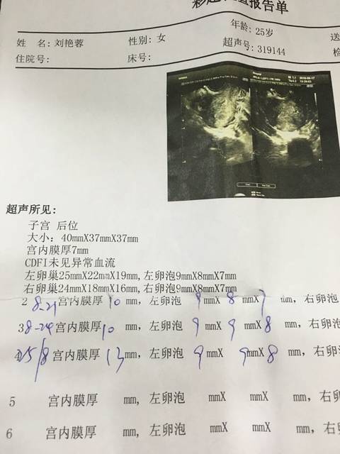 做供卵试管婴儿的详细过程