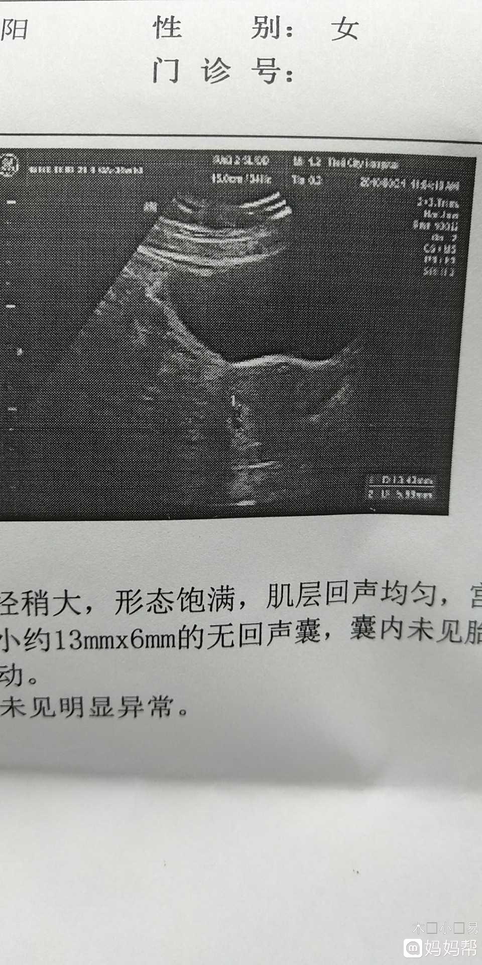 乌克兰第四代赠卵助孕自怀试管过程!什么是赠卵助孕自怀试管技术
