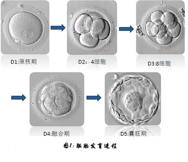 借卵试管为啥会宫外孕