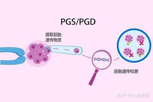 第三代供卵试管代怀推荐医院可以筛查染色体缺失吗？