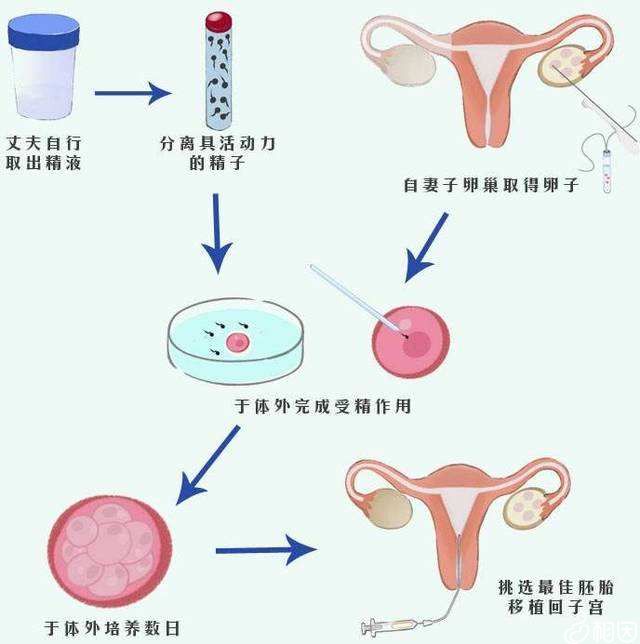 武汉二代女子试管代怀孕包生男孩费用大概多少钱？附武汉二代代怀三代自取自怀医院排名