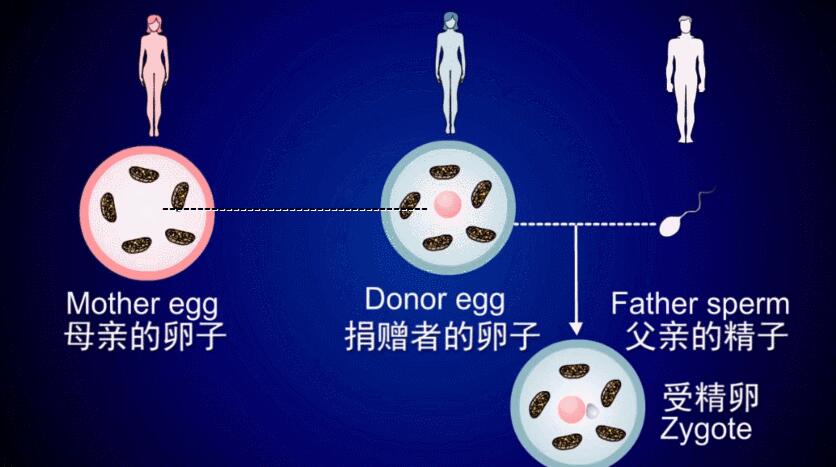 血糖高的人精子可以怀孕吗