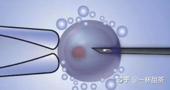 武汉市代怀生男孩女孩包成功费用,附2024本地代怀机构检查项目明细