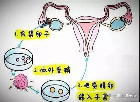 武汉代生试管生女孩术前检查到移植大约需要多少钱