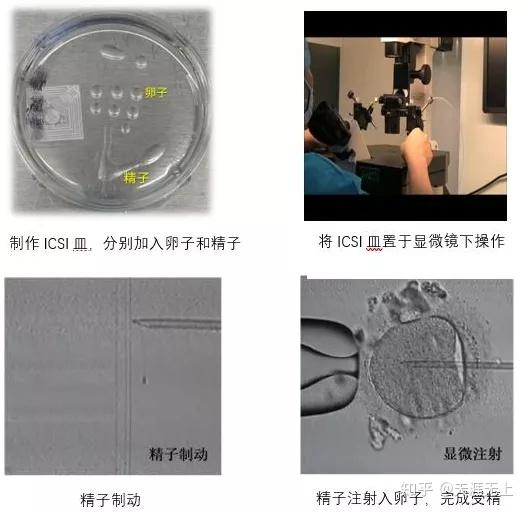 武汉哪家医院天楚代怀网的成功率比较高